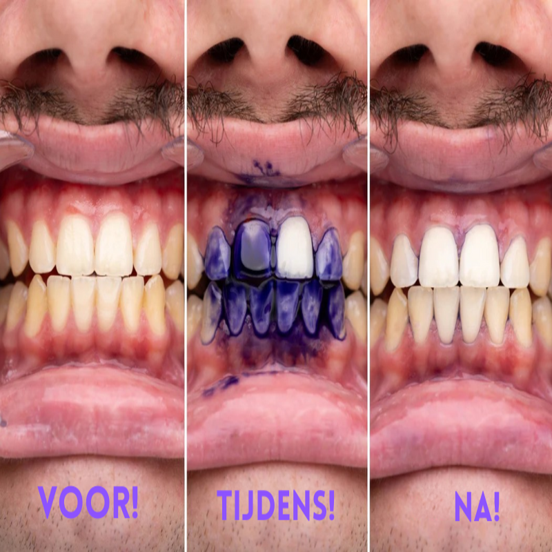 V34 Colour Corrector Serum - Voor een stralend wit gebit!